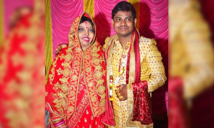 Người phụ nữ bất hạnh bị tạt axit đã tìm thấy tình yêu của đời mình