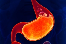 không nên dùng thuốc ức chế bơm proton