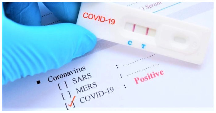 kit test của Việt Á