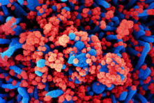 Miễn dịch tự nhiên