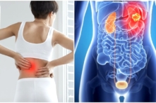 Đau thắt lưng do bệnh thận