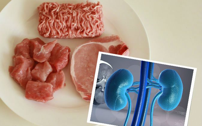 Cách ăn uống tốt cho thận