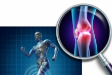 Viêm xương khớp là dạng viêm khớp phổ biến nhất và thường xảy ra khi các mô mềm ở đầu xương bị bào mòn. (Ảnh: Được sự cho phép của Karena Wu)