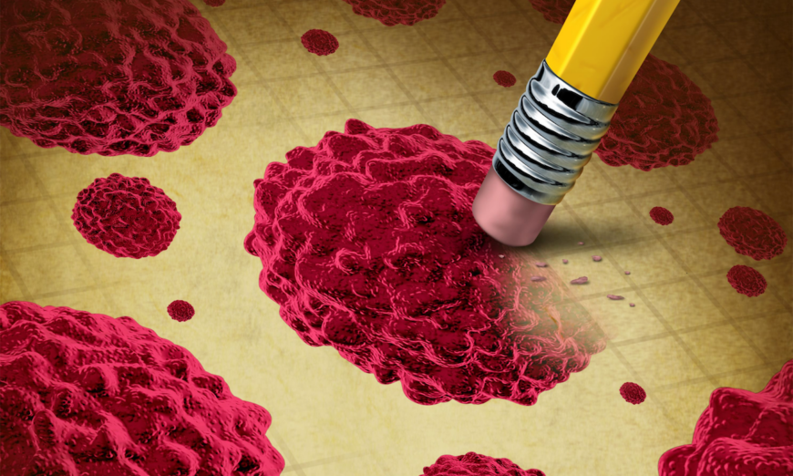 Lightspring/Shutterstock