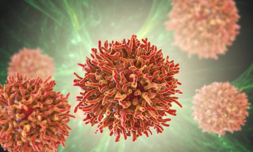 Ung thư có thể không phải là bệnh di truyền (Ảnh: Kateryna Kon/Shutterstock)