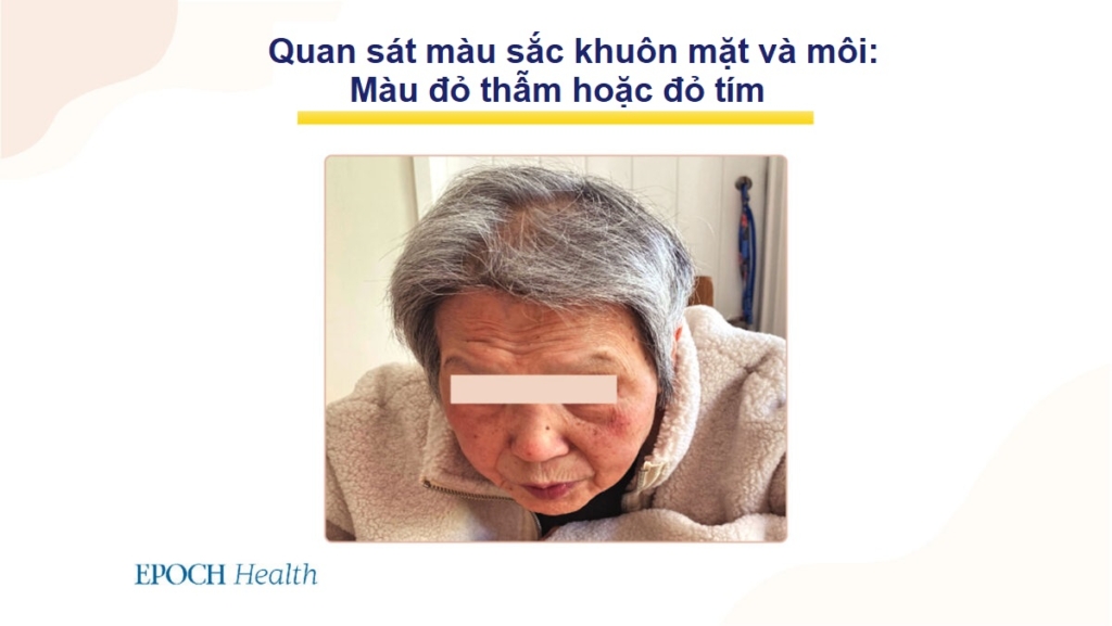 COVID-19 làm tăng nguy cơ bị bệnh tim – Các dấu hiệu nguy cấp và mẹo để phòng ngừa