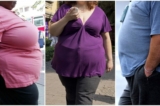 Báo cáo: ‘Mối liên quan chặt chẽ’ giữa béo phì và bệnh tự miễn