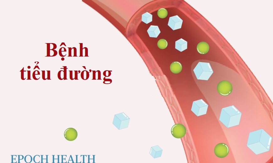 Bệnh tiểu đường: Dấu hiệu sớm, nguyên nhân, điều trị, và giải pháp tự nhiên