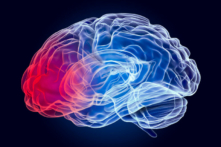 Bệnh Parkinson là một rối loạn hiếm gặp trong phần lớn lịch sử loài người. (Ảnh: AlexLMX/Shutterstock)