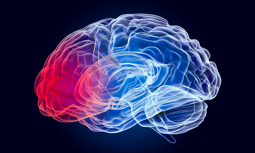 Bệnh Parkinson là một rối loạn hiếm gặp trong phần lớn lịch sử loài người. (Ảnh: AlexLMX/Shutterstock)