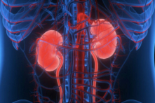 Bệnh thận có thể tiến triển đến giai đoạn suy thận, khiến người bệnh phải lọc máu hoặc ghép thận. (Ảnh: Shutterstock)