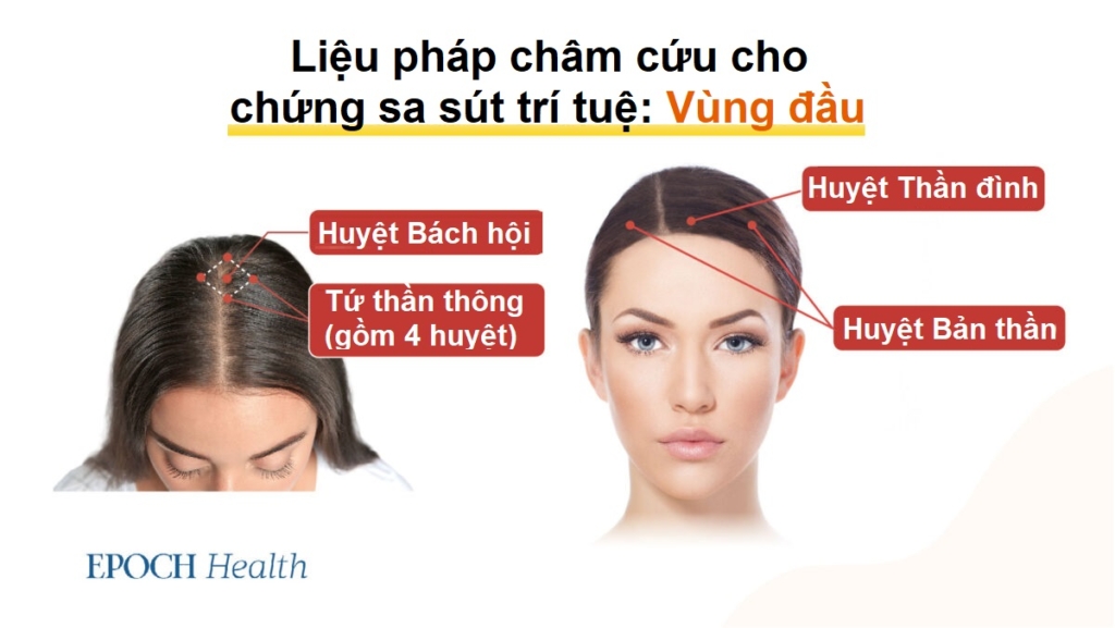 5 môn thể thao dễ gây tổn thương não và các liệu pháp cổ xưa giúp khắc phục chứng sa sút trí tuệ