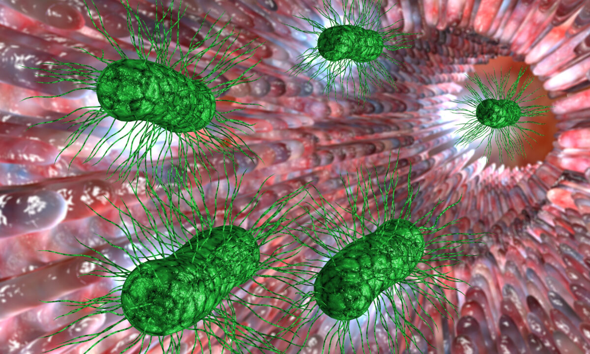 Quá phát vi khuẩn ruột non (SIBO) nổi tiếng là không được chẩn đoán đúng mức vì nhiều triệu chứng của bệnh tương tự như các vấn đề sức khỏe khác.(Ảnh: Ezume Images/Shutterstock)