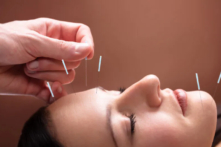 Giải quyết các khiếm khuyết bẩm sinh bằng thời châm (Ảnh: Andrey_Popov/Shutterstock)