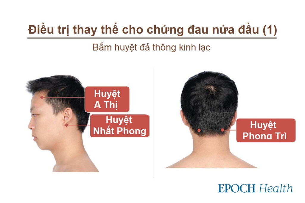 4 loại đau nửa đầu và 4 cách điều trị đau nửa đầu tại nhà