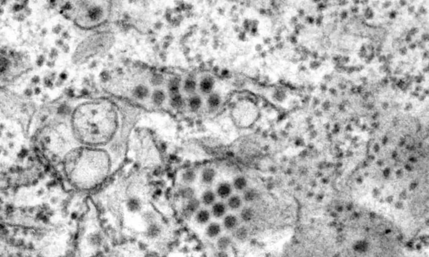 Hình ảnh qua kính hiển vi điện tử truyền qua mô tả một số hạt virus sốt xuất huyết hình tròn được phát hiện trong mẫu mô. (Ảnh: Frederick Murphy/Trung tâm Kiểm soát và Phòng ngừa Dịch bệnh Hoa Kỳ)