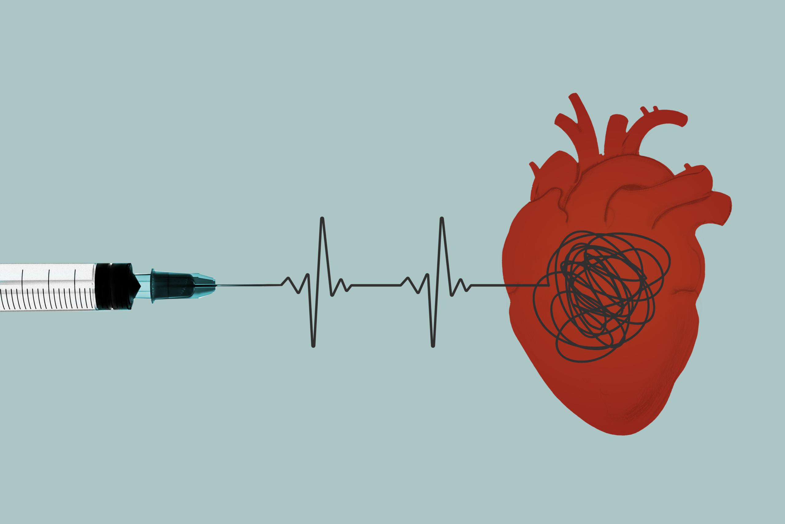 Họ bị viêm cơ tim sau khi chích vaccine COVID-19. Sau hàng năm, một số người vẫn chưa hồi phục