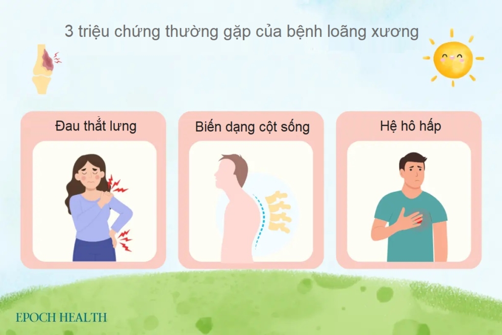 Các yếu tố nguy cơ và cách phòng loãng xương cổ xưa