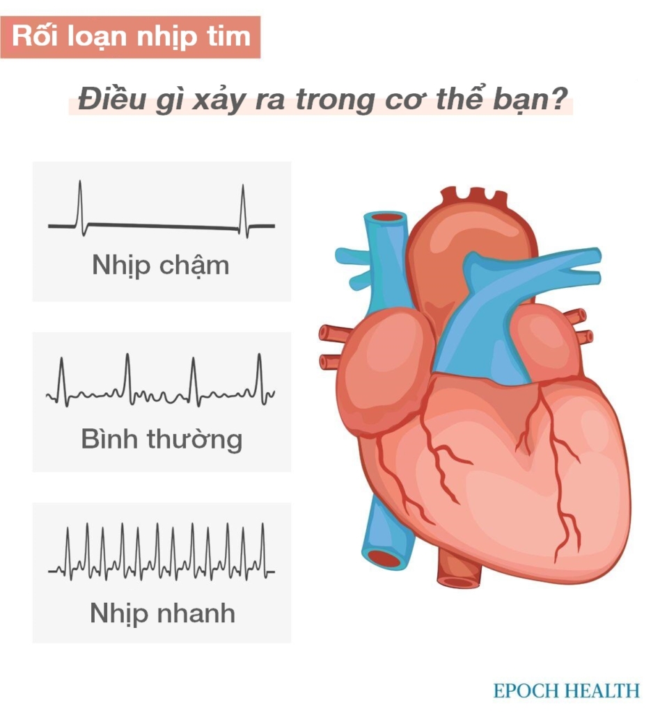 Hướng dẫn cơ bản về bệnh tim: Triệu chứng, nguyên nhân, điều trị và các liệu pháp tự nhiên