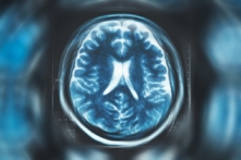 (Ảnh: DedMityay/Shutterstock)