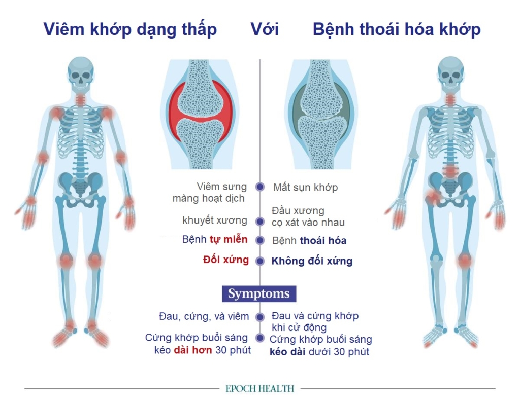Năm bài tập cho người thoái hóa và phục hồi chức năng khớp