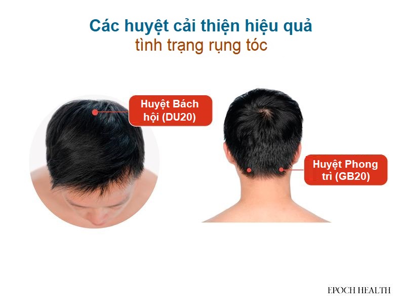 Cách tự nhiên nuôi dưỡng mái tóc dày dặn và chắc khỏe, 6 cách giảm rụng tóc