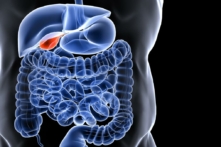 Các vấn đề liên quan đến túi mật thường xảy ra sau bữa ăn thịnh soạn. (Ảnh: Shutterstock)