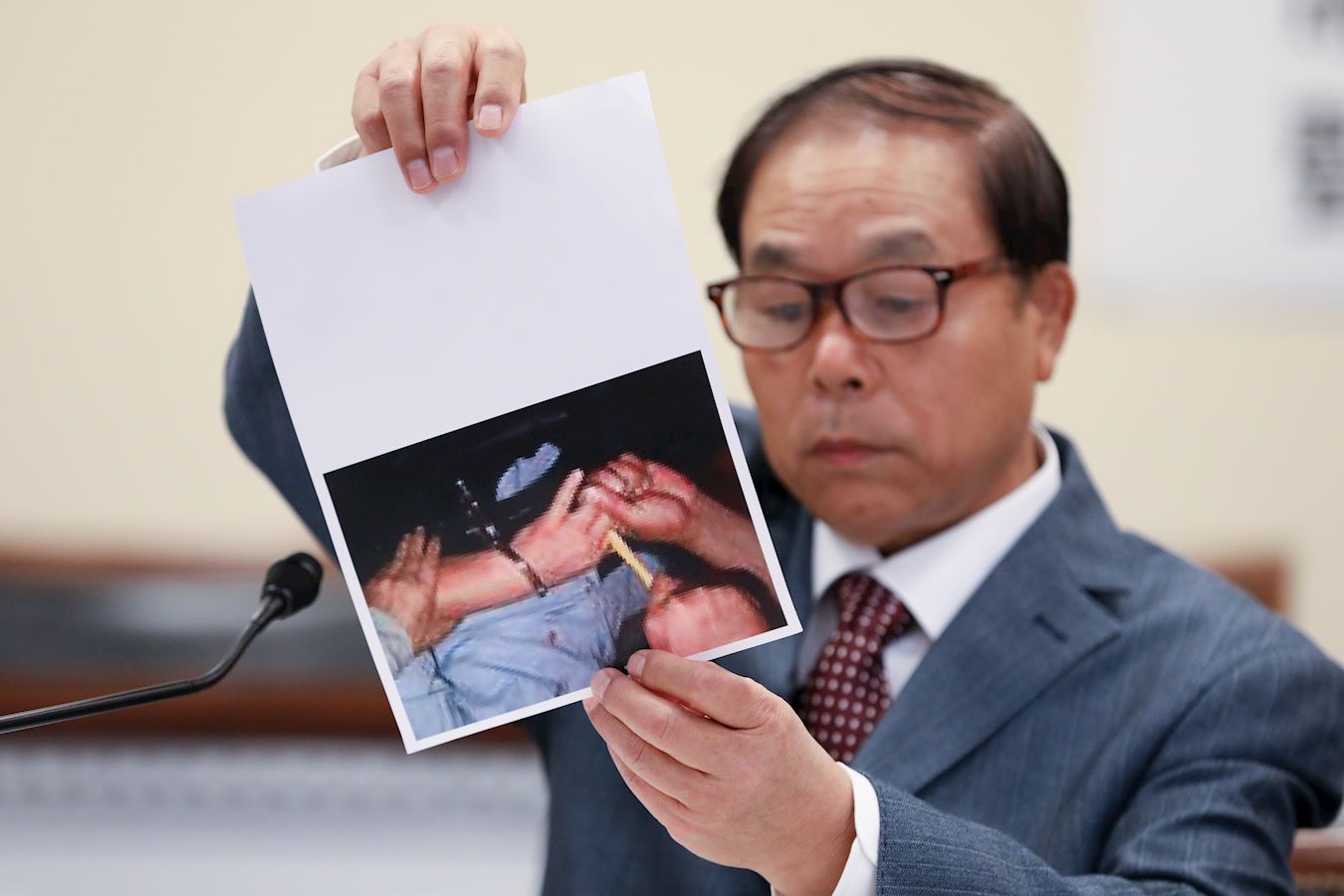 Năm 2018, trong một hội thảo được tổ chức tại Tòa nhà Quốc hội Hoa Kỳ, ông Lưu Tích Đồng đã kể lại việc bản thân đã bị tra tấn bằng cách “dùng bàn chải đánh răng chà vào kẽ ngón tay” và chịu nhiều hình thức tra tấn khác trong thời gian bị giam giữ bất hợp pháp tại Trung Quốc. (Ảnh: Epoch Times)