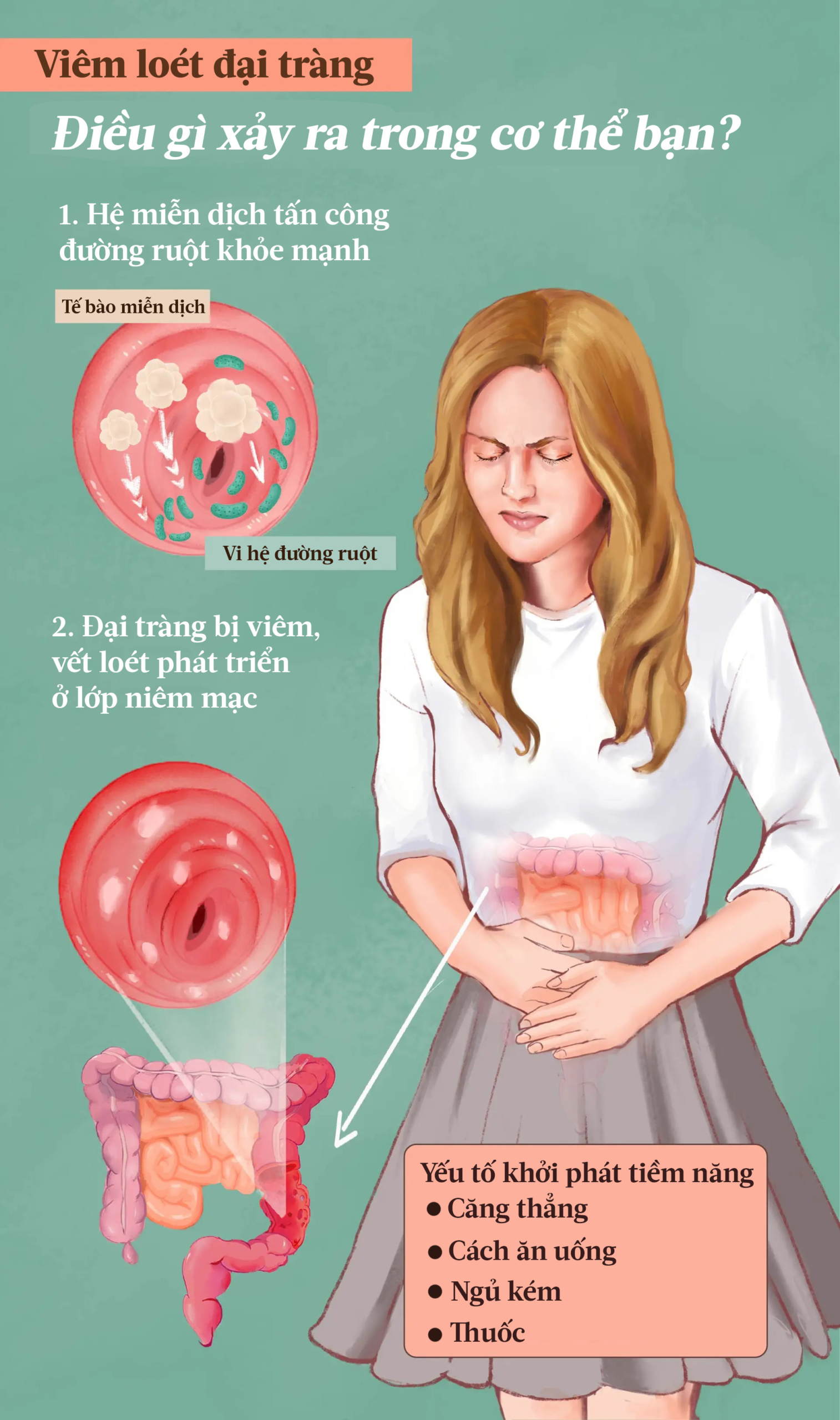 Viêm loét đại tràng: Triệu chứng, nguyên nhân, phương pháp điều trị và cách tiếp cận tự nhiên