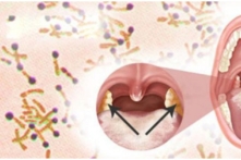 Việt Nam: Bắc Giang, Nghệ An ghi nhận 2 bệnh nhân mắc bạch hầu, 1 người tử vong