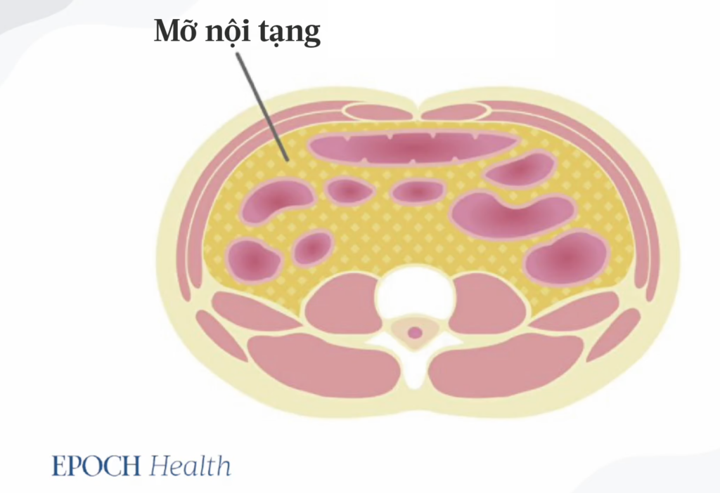 Mỡ nội tạng là chất béo bao quanh các cơ quan. (Ảnh: EPOCH Health)